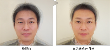 顔力マッサージの平均顔